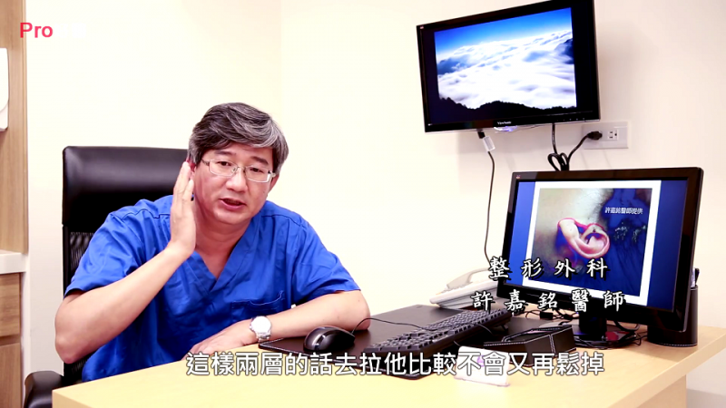 拉皮手術只切掉一塊皮就夠？拉皮的真正做法要拉雙層？